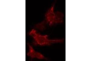 ABIN6275607 staining  HeLa cells by IF/ICC. (SFRS2B 抗体  (Internal Region))