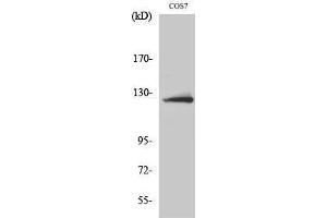 Western Blotting (WB) image for anti-ATP Citrate Lyase (ACLY) (Ser1227) antibody (ABIN3183445) (ACLY 抗体  (Ser1227))