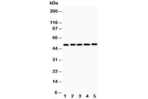 Western blot testing of LXR alpha antibody and Lane 1:  rat liver;  2: rat lung;  3: rat spleen;  4: rat kidney;  5: human placenta;  Predicted size: 51KD;  Observed size: 51KD (NR1H3 抗体  (C-Term))