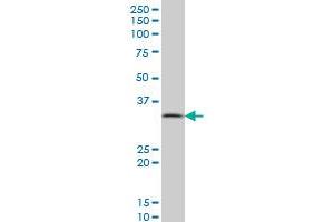 PPA1 monoclonal antibody (M01), clone 3B2 Western Blot analysis of PPA1 expression in A-431 . (Pyrophosphatase (Inorganic) 1 (PPA1) (AA 10-111) 抗体)