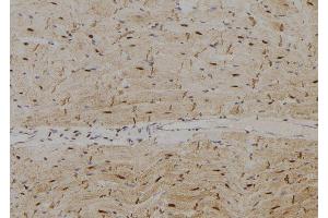 ABIN6278780 at 1/100 staining Rat heart tissue by IHC-P. (SPZ1 抗体  (Internal Region))