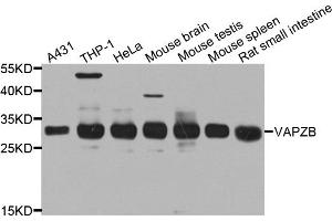 Western blot analysis of extracts of various cell lines, using CAPZB antibody. (CAPZB 抗体)