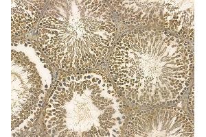 MTBP Mouse Monoclonal Antibody at 1/100 staining rat testis tissue by IHC-P. (MTBP 抗体)