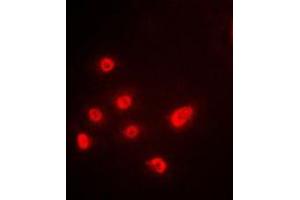 Immunofluorescent analysis of p63 staining in A549 cells. (TCP1 alpha/CCTA 抗体  (C-Term))