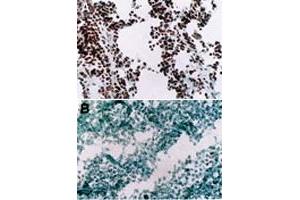 Immunohistochemistry (Frozen sections) using Myod1 monoclonal antibody, clone 5. (MYOD1 抗体  (AA 180-189))