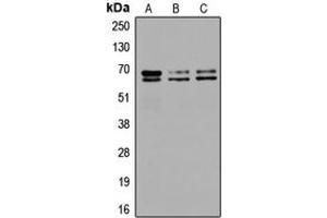 Western blot analysis of GAD1/2 expression in SKNSH (A), SP2/0 (B), PC12 (C) whole cell lysates. (GAD65+GAD67 (C-Term) 抗体)