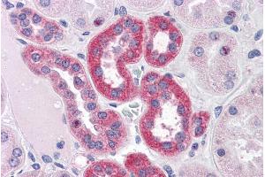 ABIN308468 (3. (PARP3 抗体  (Internal Region))