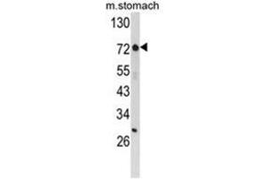 Western blot analysis of ZFP36 Antibody (ZNF823 抗体  (Middle Region))