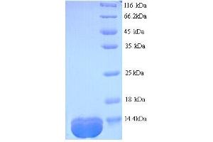 Cystatin C (CST3) (AA 2-102), (full length) protein (His tag)
