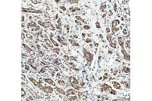 IHC analysis of PDK2 using anti-PDK2 antibody (ABIN5693279).