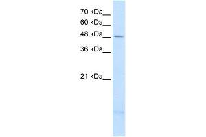PSD3 antibody used at 2. (PSD3 抗体  (Middle Region))