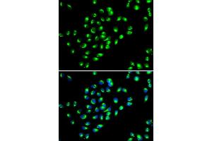 Immunofluorescence analysis of MCF-7 cells using GOLM1 antibody. (GOLM1 抗体)