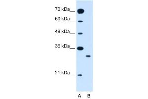 WB Suggested Anti-SLC25A22  Antibody Titration: 1. (SLC25A22 抗体  (N-Term))