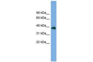 Image no. 1 for anti-Death Effector Domain Containing 2 (DEDD2) (AA 179-228) antibody (ABIN6744979) (DEDD2 抗体  (AA 179-228))