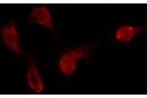ABIN6275417 staining Hela by IF/ICC. (DYRK3 抗体)
