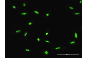 Immunofluorescence of purified MaxPab antibody to ADAR on HeLa cell. (ADAR 抗体  (AA 1-1226))