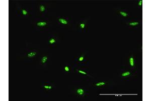 Immunofluorescence of purified MaxPab antibody to ADAR on HeLa cell. (ADAR 抗体  (AA 1-1226))
