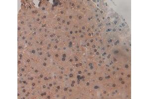 IHC-P analysis of liver tissue, with DAB staining. (TNP1 抗体  (AA 3-53))