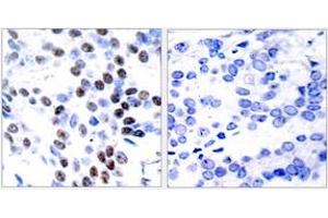 Immunohistochemistry (IHC) image for anti-Jun Proto-Oncogene (JUN) (AA 61-110) antibody (ABIN2889016) (C-JUN 抗体  (AA 61-110))