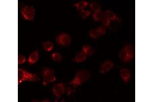 ABIN6276861 staining LOVO by IF/ICC. (Cadherin 13 抗体  (Internal Region))