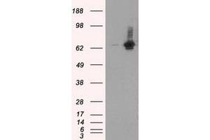 Western Blotting (WB) image for anti-RalA Binding Protein 1 (RALBP1) antibody (ABIN1500587) (RALBP1 抗体)