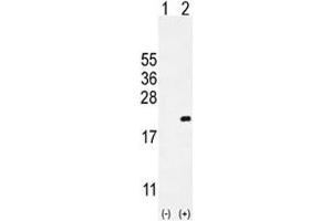 Western blot analysis of CDKN2C antibody and 293 cell lysate either nontransfected (Lane 1) or transiently transfected (2) with the CDKN2C gene. (CDKN2C 抗体  (AA 113-139))
