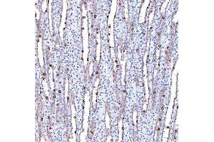 IHC analysis of SUCLG1 using anti-SUCLG1 antibody (ABIN7600906). (SUCLG1 抗体  (AA 25-346))