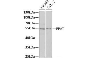 Western blot analysis of extracts of various cell lines using PPAT Polyclonal Antibody at dilution of 1:1000. (PPAT 抗体)