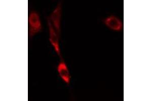 ABIN6274817 staining COLO205 cells by IF/ICC. (ARF6 抗体  (Internal Region))