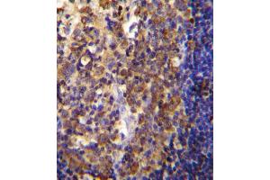His6-DEP-1 Antibody immunohistochemistry analysis in formalin fixed and paraffin embedded human tonsil tissue followed by peroxidase conjugation of the secondary antibody and DAB staining. (PTPRJ 抗体  (His6))