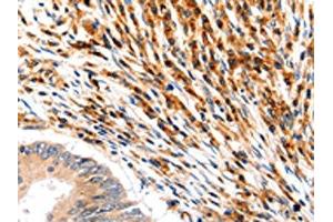 Immunohistochemistry (IHC) image for anti-Solute Carrier Family 2 (Facilitated Glucose/fructose Transporter), Member 5 (SLC2A5) antibody (ABIN7192466)