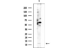 anti-Prokineticin 1 (Prok1) antibody