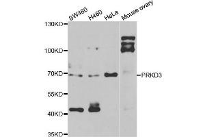 Western blot analysis of extracts of various cell lines, using PRKD3 antibody. (PRKD3 抗体)
