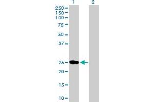 Western Blot analysis of DUSP19 expression in transfected 293T cell line by DUSP19 MaxPab polyclonal antibody. (DUSP19 抗体  (AA 1-217))