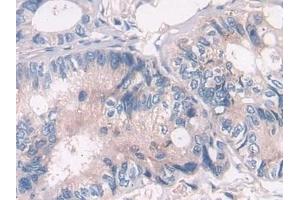 Immunohistochemistry (IHC) image for anti-ATPase, H+ Transporting, Lysosomal Accessory Protein 2 (ATP6AP2) (AA 17-302) antibody (ABIN7439744)