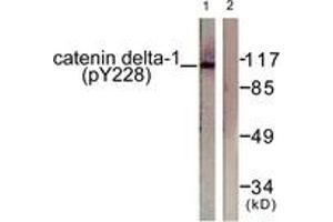 Western blot analysis of extracts from HuvEc cells, using Catenin-delta1 (Phospho-Tyr228) Antibody. (CTNND1 抗体  (pTyr228))