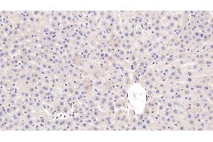 Detection of CRP in Rat Liver Tissue using Monoclonal Antibody to C Reactive Protein (CRP) (CRP 抗体  (AA 20-230))