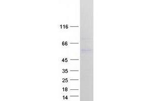Validation with Western Blot (HERPUD1 Protein (Transcript Variant 3) (Myc-DYKDDDDK Tag))