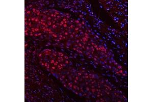 anti-tRNA Methyltransferase 6 Homolog (TRMT6) (AA 6-489) antibody