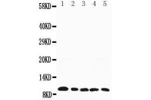 Western Blotting (WB) image for anti-Chemokine (C-C Motif) Ligand 4 (CCL4) (AA 74-88), (C-Term) antibody (ABIN3042607)