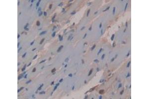 Immunohistochemistry (IHC) image for anti-X-Linked Inhibitor of Apoptosis (XIAP) (AA 8-219) antibody (ABIN5013736)