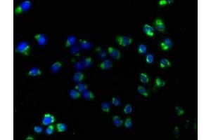 Immunofluorescence staining of Hela cells with ABIN7170052 at 1:160, counter-stained with DAPI. (ATP1B3 抗体  (AA 57-279))