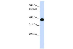 Western Blotting (WB) image for anti-Sphingolipid Delta(4)-Desaturase DES1 (DEGS1) antibody (ABIN2458939) (DEGS1 抗体)