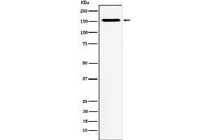 Western blot analysis of WAPL expression in Jurkat cell lysate.