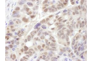 anti-Proteasome (Prosome, Macropain) 26S Subunit, ATPase, 1 (PSMC1) (AA 390-440) antibody