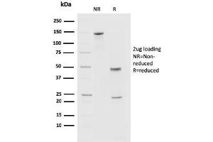 SDS-PAGE Analysis of Purified PD1 (CD279) Mouse Monoclonal Antibody (PDCD1/2720). (PD-1 抗体)