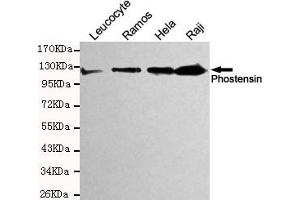 Western blot detection of Phostensin in Hela,Raji,Ramos and Leucocyte cell lysates and using Phostensin mouse mAb (1:200 diluted). (KIAA1949 抗体)