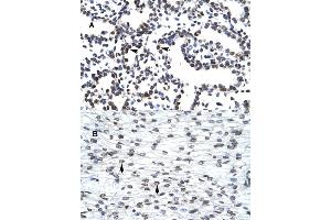 Immunohistochemical staining (Formalin-fixed paraffin-embedded sections) of (A) human lung and (B) human heart tissues with LHX3 polyclonal antibody . (LHX3 抗体  (Internal Region))