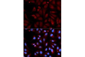 Immunofluorescence analysis of U2OS cell using MAOB antibody. (Monoamine Oxidase B 抗体  (AA 1-260))