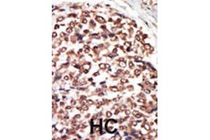 Immunohistochemistry (IHC) image for anti-Protein Kinase D3 (PRKD3) antibody (ABIN3002938) (PRKD3 抗体)